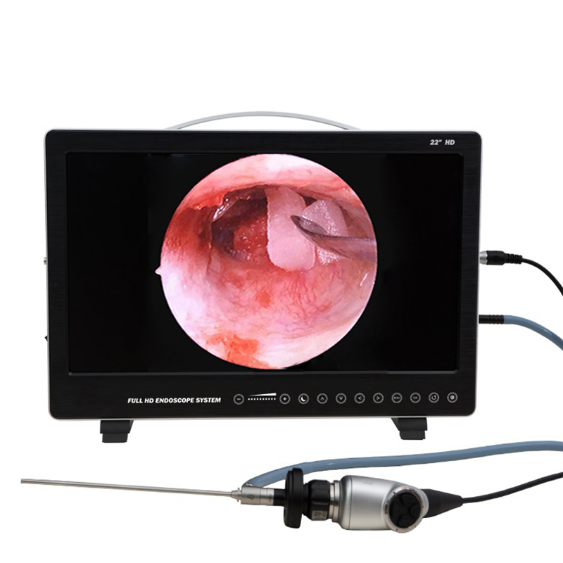 Laptop Accessories All In One - Sistema di telecamere per endoscopio da