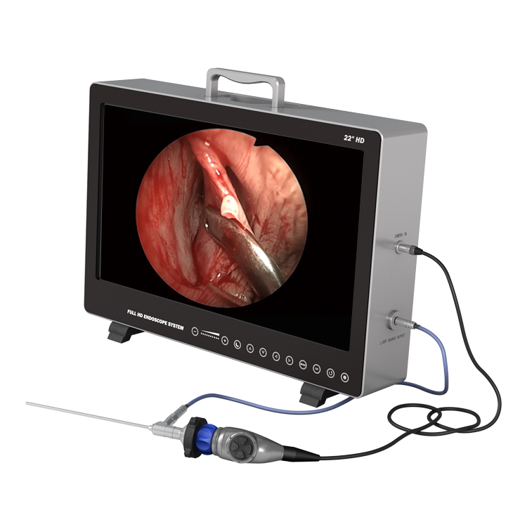 Sistema di telecamere per endo - Laptop Accessories All In One recensione e prezzo